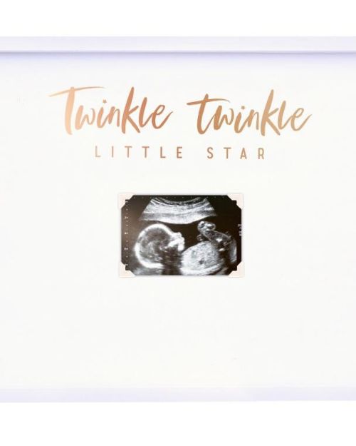 Twinkle Twinkle Baby Scan Guest Book Frame
