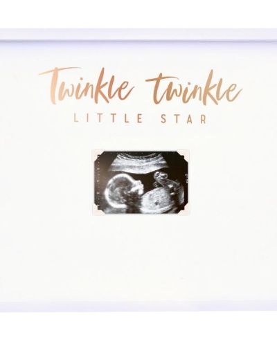 Twinkle Twinkle Baby Scan Guest Book Frame